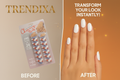 Before & After Banner